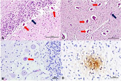 Congenital Neurological Disease Associated With HoBi-like Pestivirus Infection in a Newborn Dairy Calf From Brazil